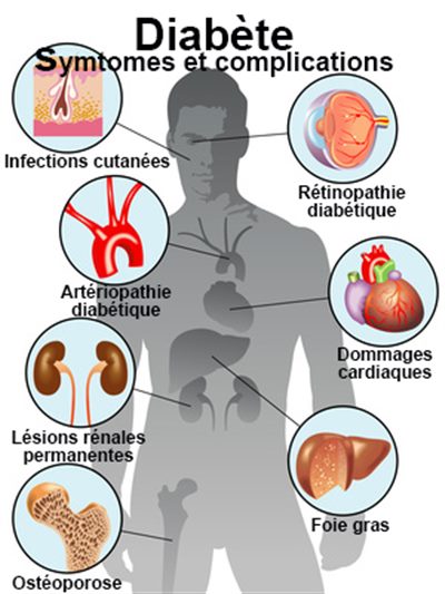 celebration-de-la-journee-mondiale-de-lutte-contre-le-diabete